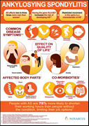 Ankylosing Spondylitis Infographic