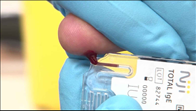 Niji Total IgE Test cartridge for blood sample